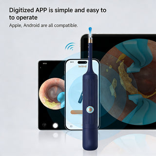 Sakerplus® Ear Wax Removal Tool Camera