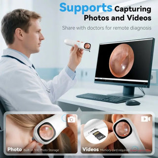 Sakerplus® 1080P HD Digital Otoscope With Screen