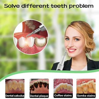 Sakerplus® Rechargeable Electric Teeth Plaque Remover