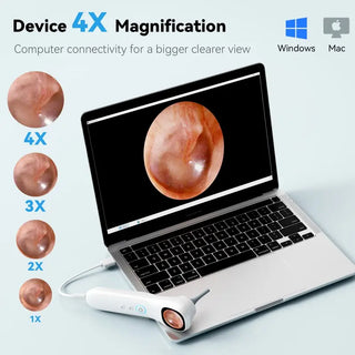 Sakerplus® 1080P HD Digital Otoscope With Screen