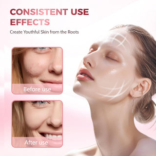 Sakerplus Red Light Therapy Face And Neck Mask